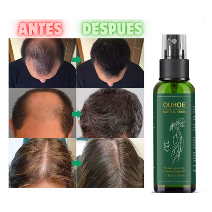 ELIXIR CAPILAR-DETÉN LA CAÍDA DEL CABELLO HOY!